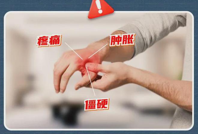手酸、手麻、腱鞘问题推荐用它！qy千亿球友会小米生态杀疯了！(图3)